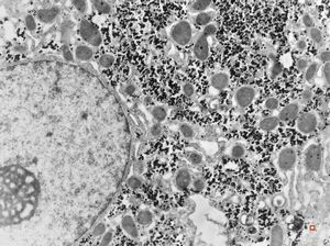 normal hepatocyte normal hepatocyte